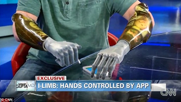 "I have been able to hold my daughter's hand for the first time in five years since my accident." -- Jason Koger 