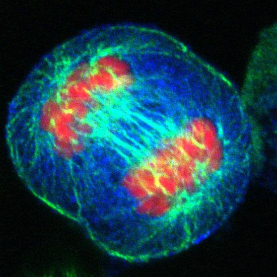 HeLa Cell during Anaphase. Credit: Matthew Daniels/Wellcome Images