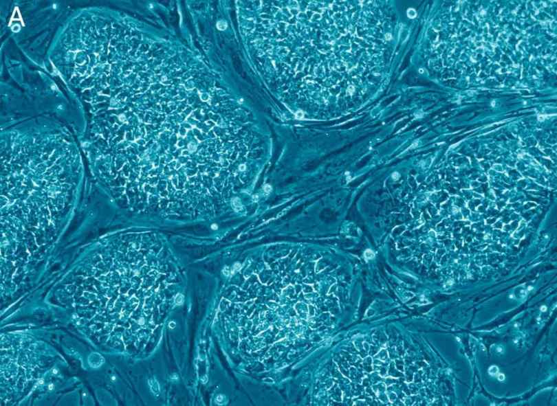 Human embryonic stem cells
